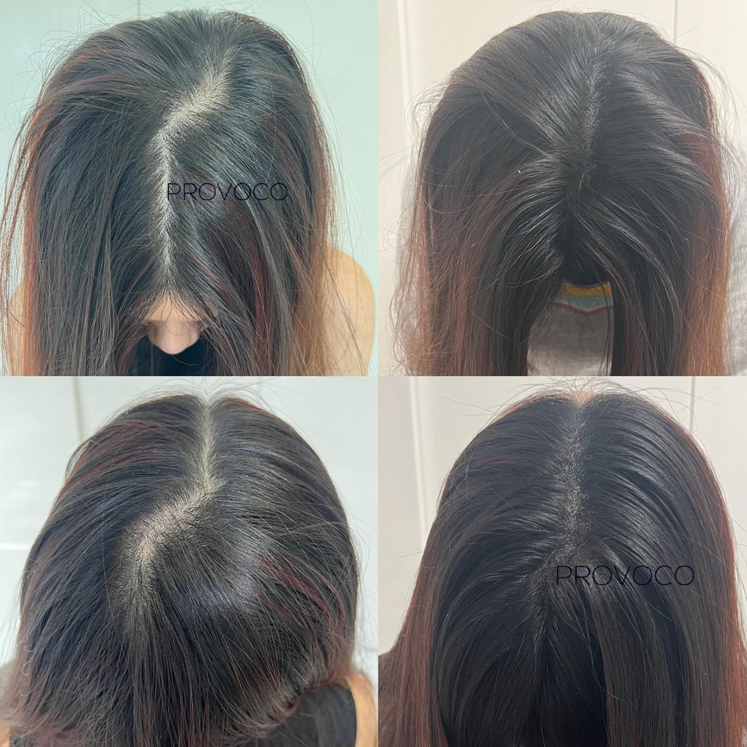 Womens Smp Parting Before After Dark Hair